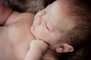 宝宝霰粒肿怎么热敷化脓了必须手术吗? 宝宝霰粒肿怎么热敷化脓了必须手术吗?